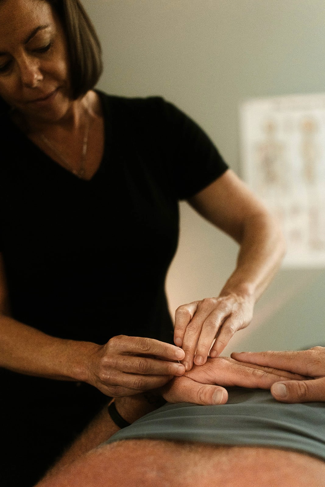Acupuncture