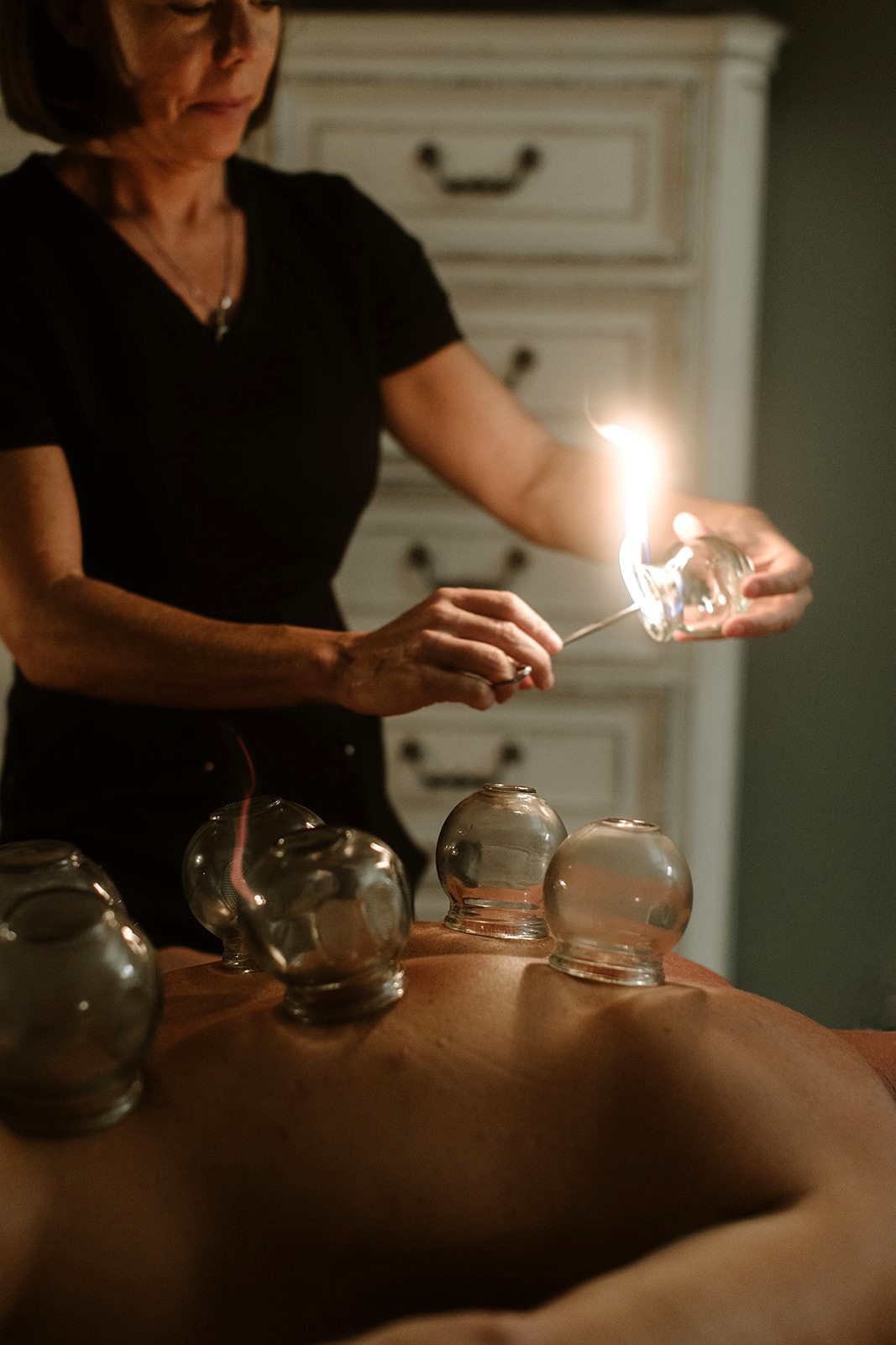 Cupping